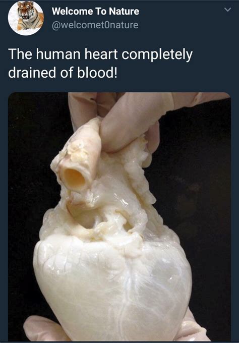 See What The Human Heart Looks Like When It Is Completely