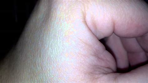 Muscle In My Hand Twitching Youtube