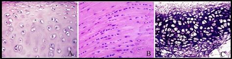 Different Types Of Cartilage A Hyaline Cartilage B Fibrocartilage