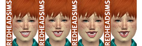 3d Realistic Teeth Child Version Redheadsims Cc