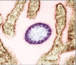 A nipah virus infection is a viral infection caused by the nipah virus. Nipah virus threat escalates | The Petri Dish