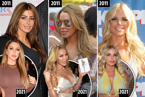 Real Housewives Of Miami Plastic Surgery Transformation See How The