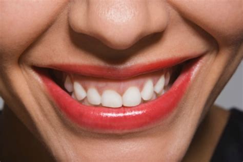 5 Reasons Pretty Teeth Are Also Good For Your Health Glamour