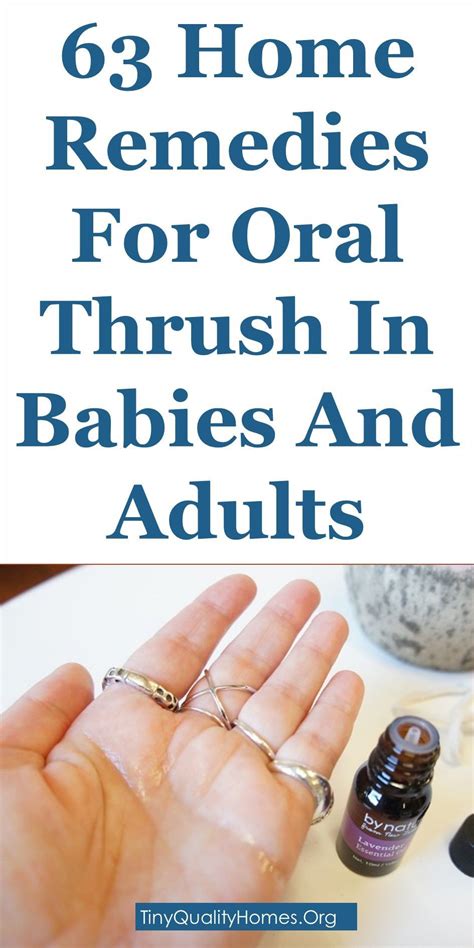 63 Home Remedies For Oral Thrush In Babies And Adults