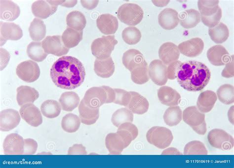 White Blood Cells In Blood Smear Stock Image Image Of Care