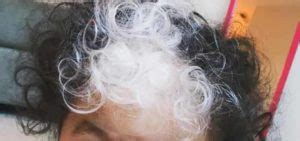 Baby Born With White Hair Causes Treatment Hair Mag