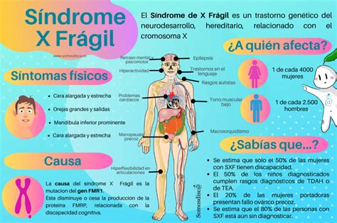 Infografía Síndrome De X Frágil Somosdisc