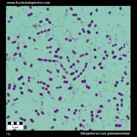 Streptococcus Pneumoniae Under Microscope Microscopy Of