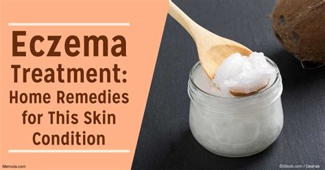 Home Cure For Eczema 9 Home Remedies For Treating Eczema The Secret