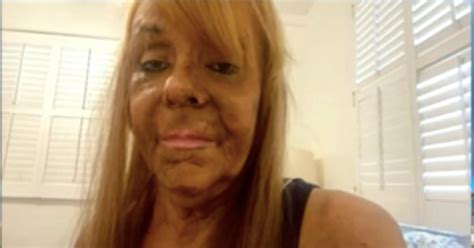 tan mom patricia krentcil claims she cut down on tanning