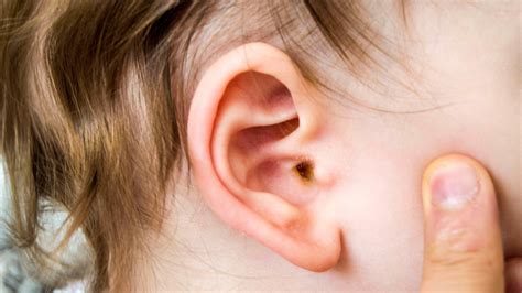 Recurrent Ear And Sinus Infections Sheila Kilbane Md