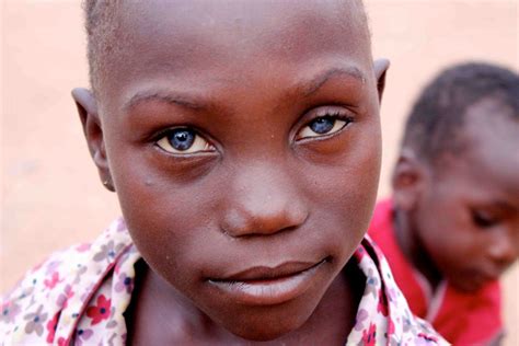 Black Baby With Blue Eyes Two African Kids With Blue Eyes Never Seen