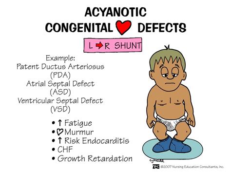 Acyanotic Congenital Heart Defects Nursing Skills And A And P Cardi