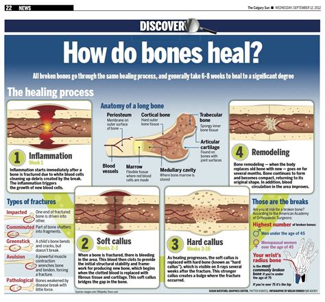 Pin By Cindy Wascow On Infographics Bone Fracture Bone Healing