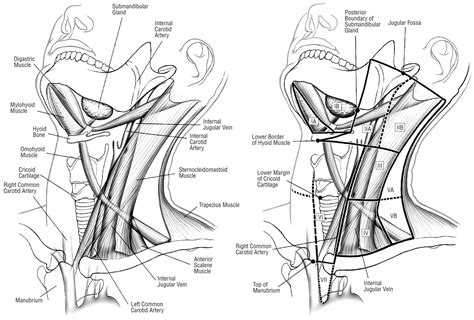 .and neck muscles diagram can help you study and research. An Imaging-Based Classification for the Cervical Nodes Designed as an Adjunct to Recent ...