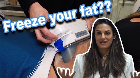 Everything You Need To Know About Coolsculpting Nazarian Plastic Surgery YouTube