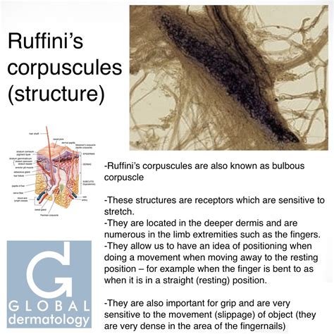 Global Dermatology Ruffinis Corpuscle Structure Instagram