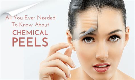 A Complete Guide To Chemical Peels Fairview Laser Clinic Inc