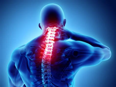 Cervical Radiculopathy A Real Pain In The Neck Lone Star Pain Medicine