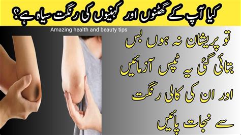 How To Get Rid Of Darkened Knees And Elbows Amazinghealthbeautytips8558