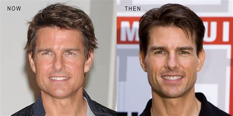 tom cruise then and now tom cruise nose job cruise