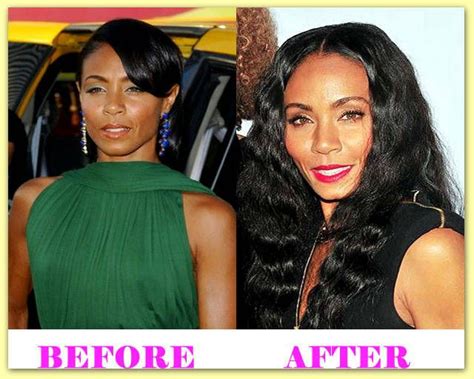 Pin By Anna Jenner On Celebrities Plastic Surgery Before And After