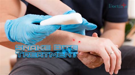 Snake Bite Treatment Protocol Treating In A Professional Way