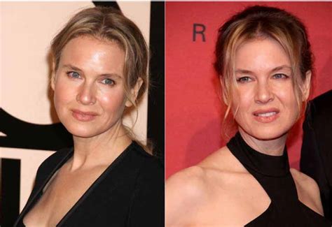 Renee zellweger before and after plastic surgery. Renee Zellweger Plastic Surgery Face Before and After ...