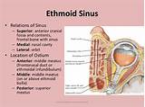 Ethmoid Sinusitis Treatment Images