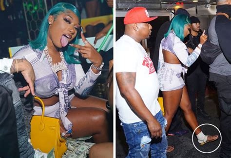 Megan Thee Stallion Posts Pics Of Her Injuries After Getting Shot In