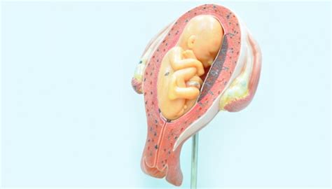 Namun sesuai dengan namanya yang berarti kuat, bayi yang baru melewati ulang tahun pertamanya ini berhasil. Kelainan Kongenital pada Bayi Sebabkan Kematian Dini ...