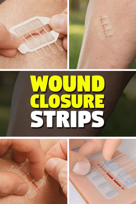 Zip Stitch Easy Wound Closure Strips No More Stitches And