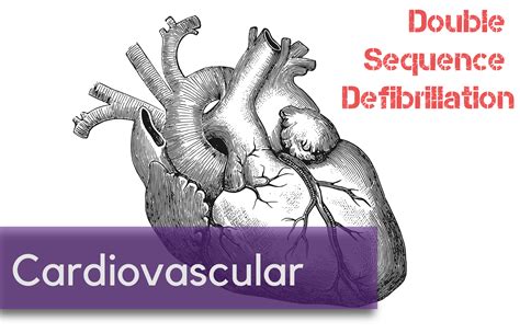 Double Sequence Defibrillation For Vfib — Nuem Blog