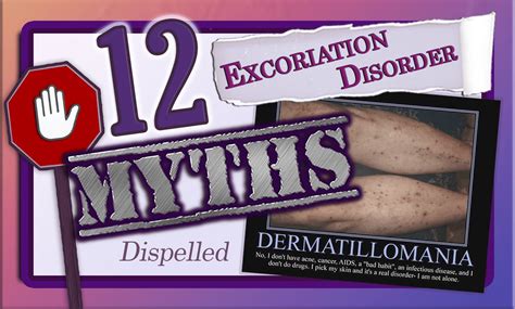12 dermatillomania myths dispelled