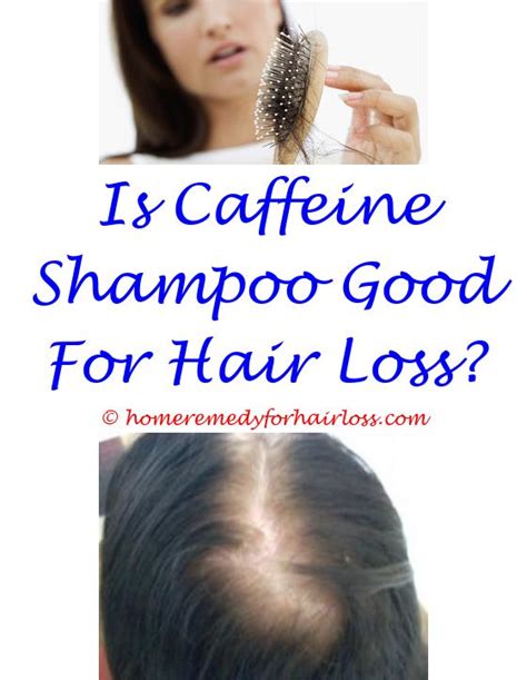 Hair loss is not usually anything to be worried about, but occasionally it can be a sign of a medical condition. Hair Replacement Therapy | Hiukset