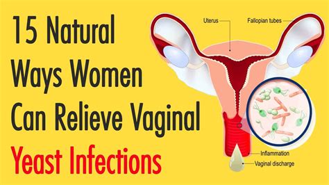 Can You Bleed From Yeast Infection Martlabpro