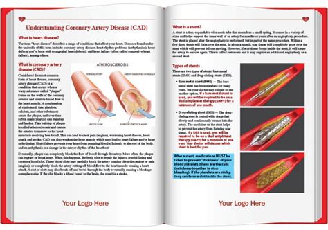 Heart Attack Angioplasty And Stent An Educational Guide For Patients