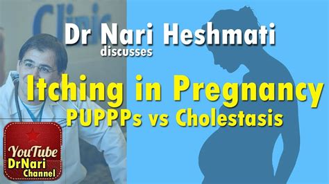 Itching In Pregnancy Puppps Vs Cholestasis Of Pregnancy Discussed By