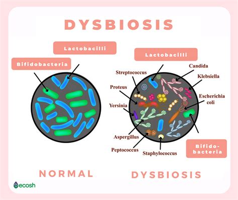 Imbalance Of Gut Microbiota Gut Dysbiosis Symptoms Causes
