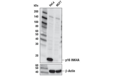 P16 Ink4a D7c1m Rabbit Mab Cell Signaling Technology