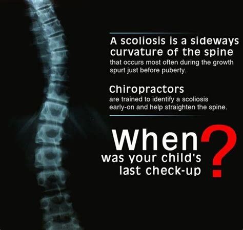 Scoliosis Can Be A Major Health Threat Scott Wagner Integrated