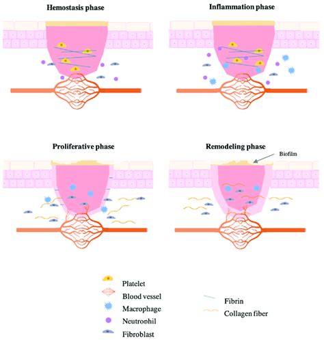 Different Phases Of Impaired Wound Healing Download Scientific Diagram