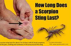 scorpion sting does last long do if stung stings bites