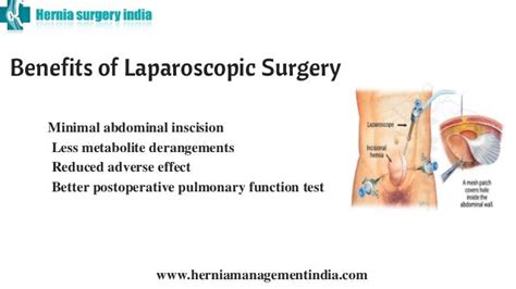 Laparoscopic Inguinal Hernia Repair In Chennai Keyhole Surgery For