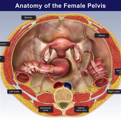Superior Cut Away View Of The Female Pelvis Trialexhibits Inc