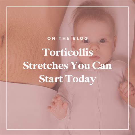 Torticollis Stretches You Can Do At Home — The Movement Mama