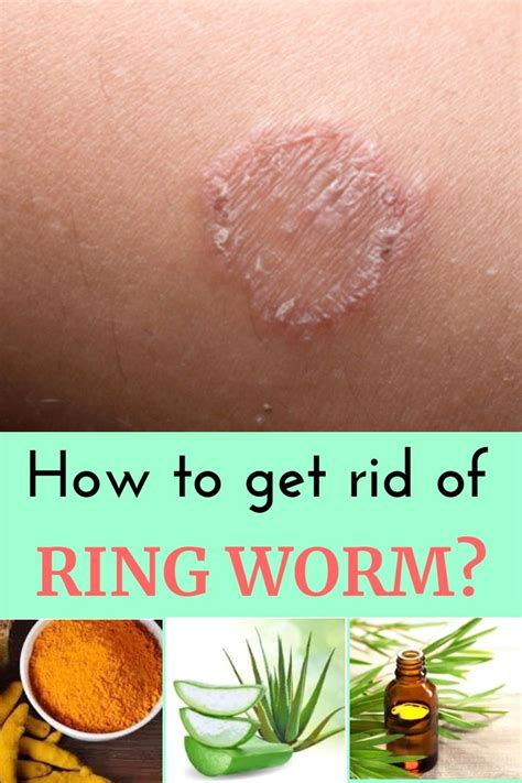 Pin By Ypetsyk On Beauty Home Remedies For Warts Home Remedies For