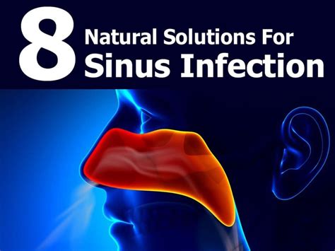 Natural Solutions Sinus Infection Sinusitis Sinus Infection Sinus
