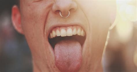 Tongue Cracks Symptoms And Causes