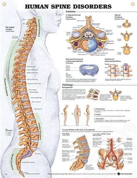 Human Spine Disorders Chart 20x26 Human Spine Human Anatomy Chart
